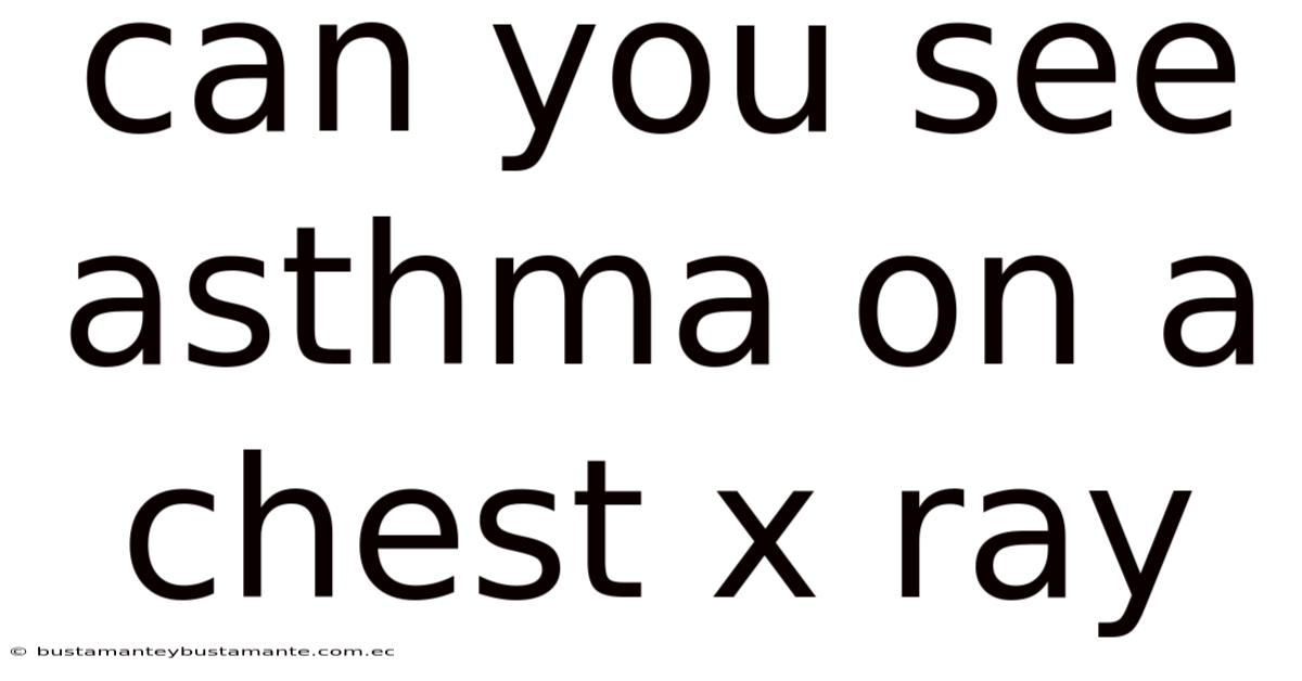 Can You See Asthma On A Chest X Ray