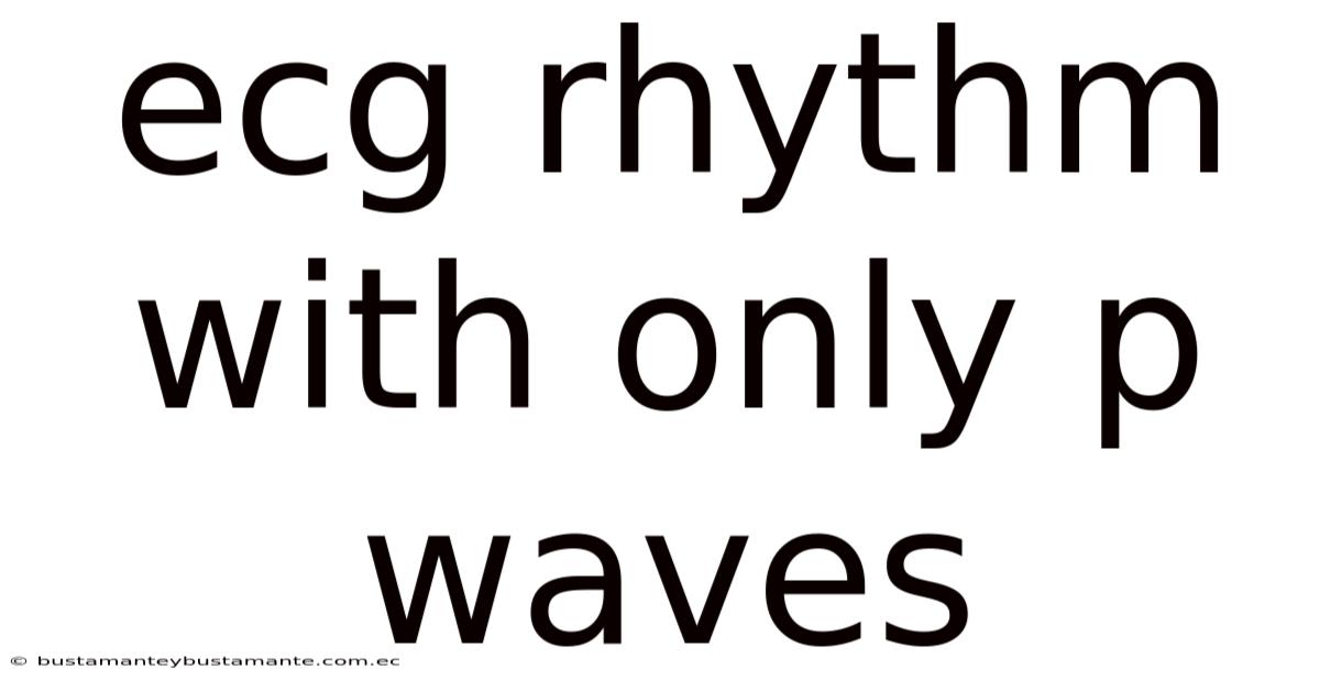 Ecg Rhythm With Only P Waves