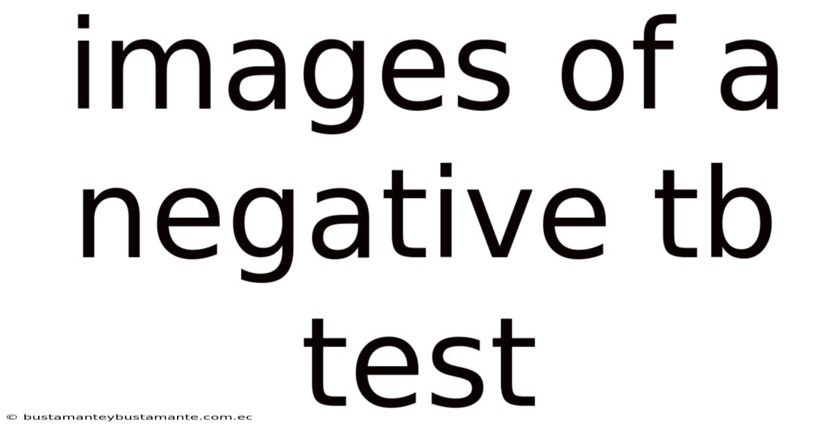 Images Of A Negative Tb Test