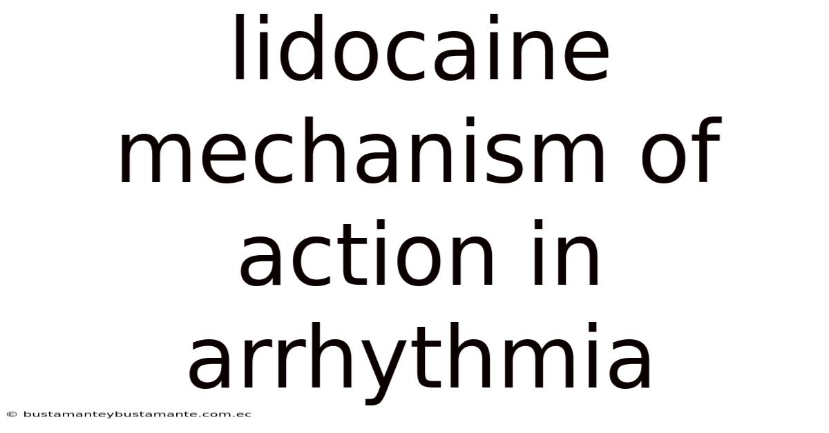 Lidocaine Mechanism Of Action In Arrhythmia