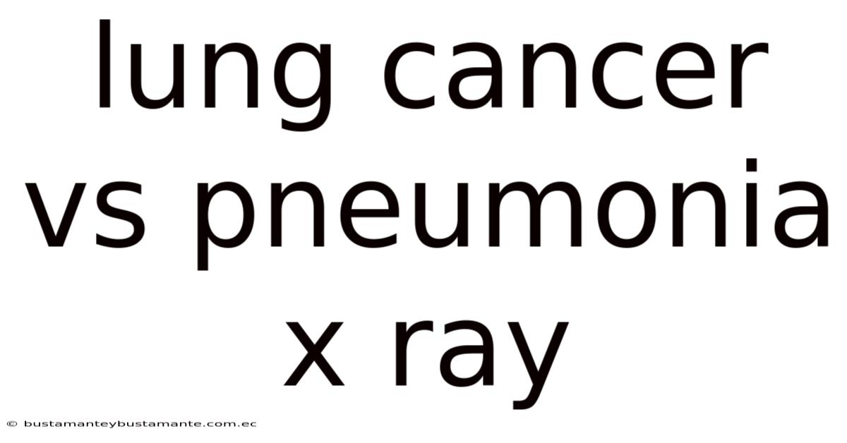 Lung Cancer Vs Pneumonia X Ray