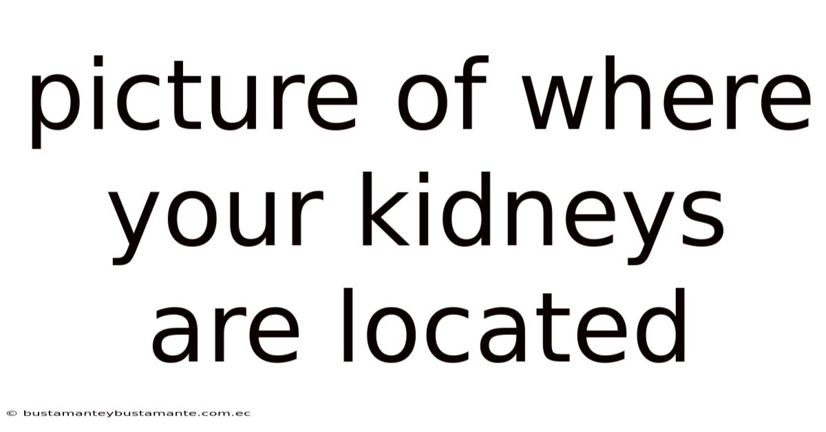 Picture Of Where Your Kidneys Are Located