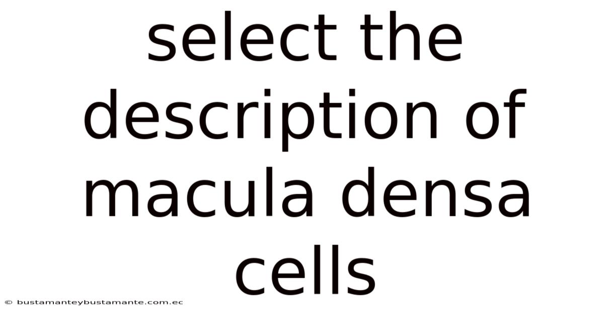 Select The Description Of Macula Densa Cells