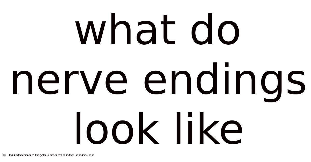 What Do Nerve Endings Look Like