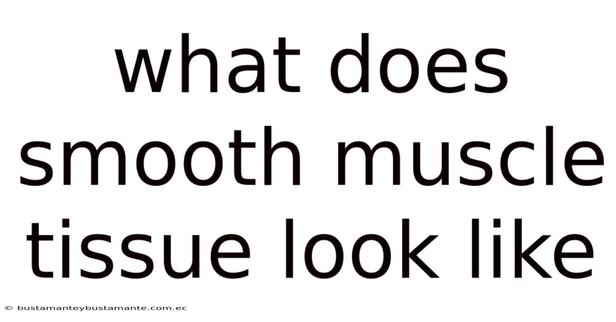 What Does Smooth Muscle Tissue Look Like